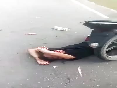 THAT PAINFUL MOMENT AFTER AN ACCIDENT