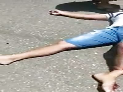 COUPLE BROKEN LEGS IN AN ACCIDENT 