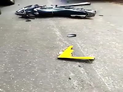 MAN GUTS EXPOSED AFTER BEING RUNOVER