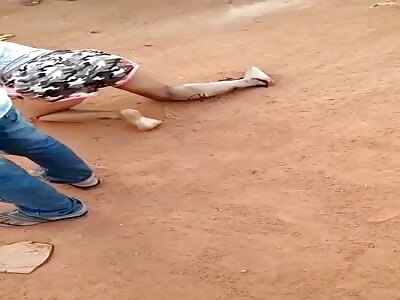 WOMAN LEG CRUSHED