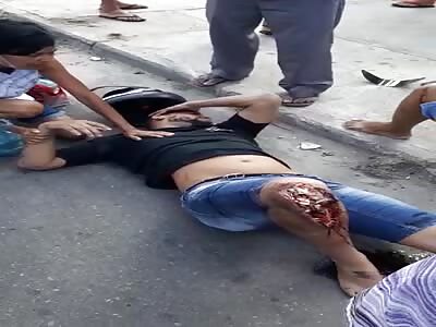 MOTORCYCLE ACCIDENT LEAVES MEN INJURED