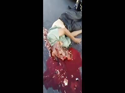 TOTALLY CRUSHED HEAD IN MOTORCYCLE ACCIDENT 