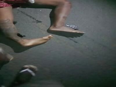 BROKEN LEG IN THE STREET