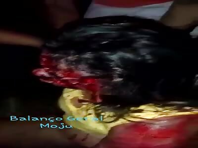 BLOODY AFTERMATH OF AN ACCIDENT