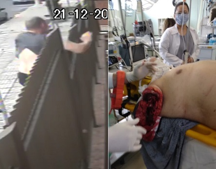 Suicidal Man Doesn't Get the Result he Wanted