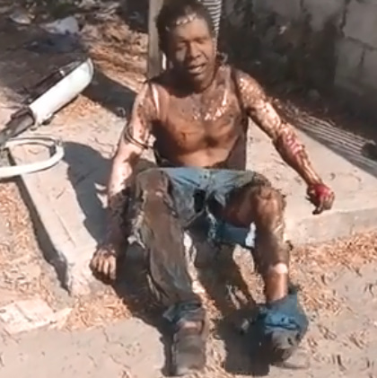 Electric Wire Thief Pays The Price