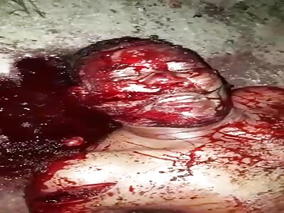 DAMN! Machete Attack Turns Guy Into A Jigsaw Puzzle.