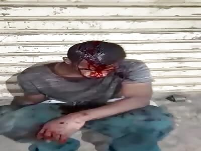 THIS GUY WAS STABBED IN THE HEAD!!!