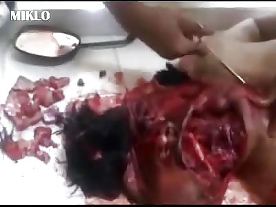 Rebuild shattered face of a man in the morgue