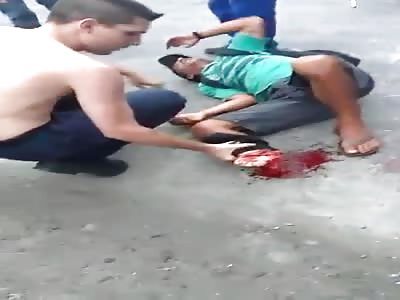 Guy with a Severed Foot by a Cargo Train 