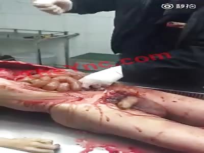 Corpse for funeral Service.