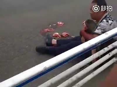 Boy head crushed by Bus.