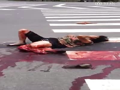 Woman screaming in agony with leg severed by Bus.