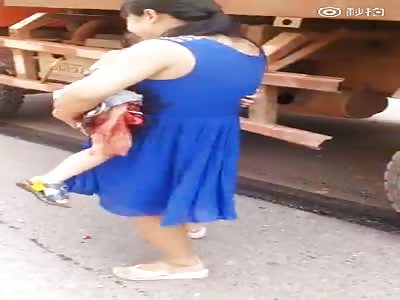 Mother cries while holding her legless son in Arms.