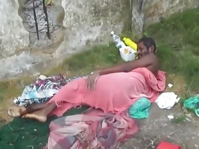  Man Has Infected Foot Crawling with Maggots