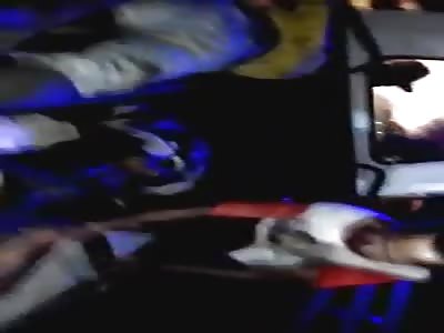 Motorcyclist loses  leg in Accident.