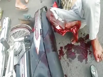 ðŸ’€ Aftermath Accident ðŸ’€