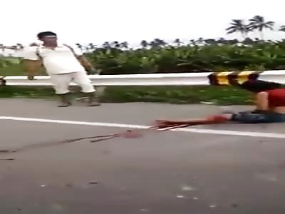 ðŸ’€ Woman Loses Leg In Accident ðŸ’€