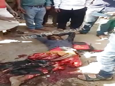 BRUTAL GORE: MAN FUCKED UP IN ACCIDENT STILL ALIVE