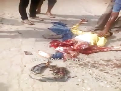 No Legs and a LOT of Pain