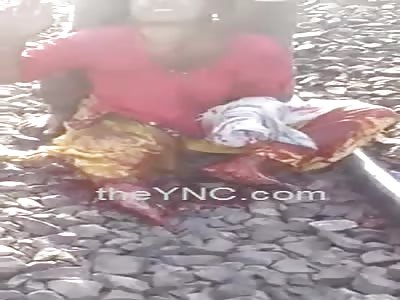 Woman Loses Leg In Train Accident