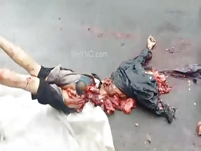 Clean Scene: Man Crushed By Truck