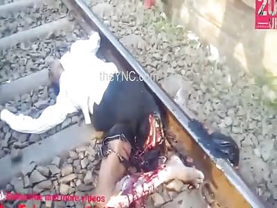 Man Loses Leg By Train
