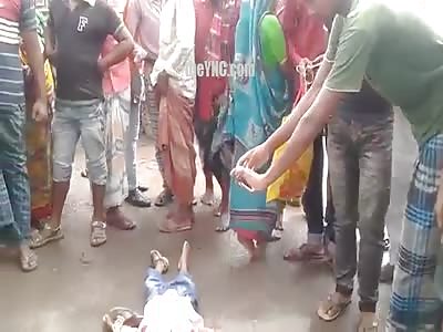 Poor Boy Had His Head Crushed and Everyone Wants to Film it