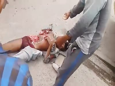 Motorcyclist Accident