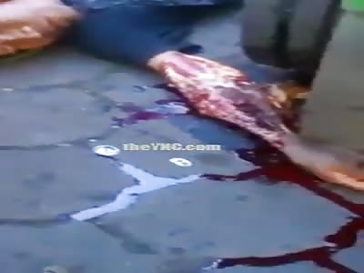 arm fucked in accident