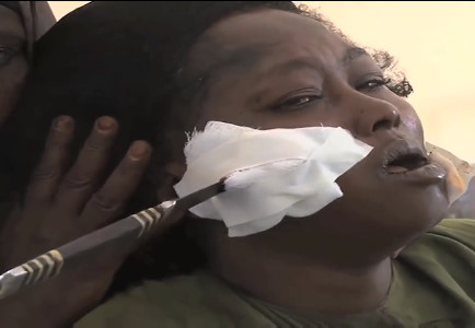 Woman with Knife embedded on his Face