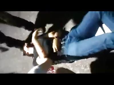 Police receives shot in the head