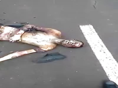 Man burned and still alive