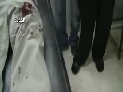  An arm with a hollow