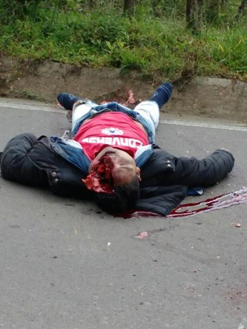 Shocking, brainless man