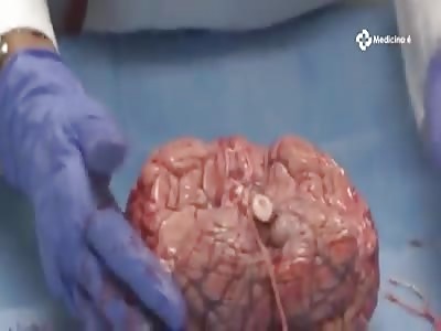 Human Brain Anatomy of the Nervous System