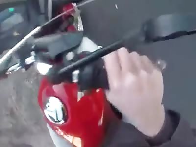 MOTORCYCLIST ALMOST LOSING A LEG IN ACCIDENT