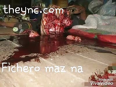 Suicide with a shotgun