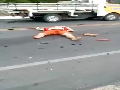 Accident leaves injured mutilated