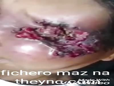 Woman with eyes full of worms