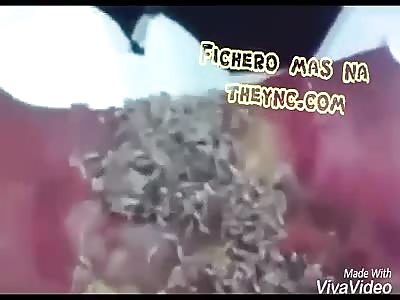 Worm infected with very graphic worm