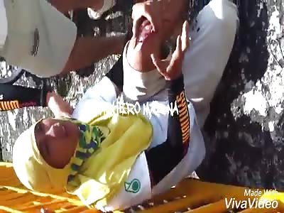 Horrible motorcycle accident