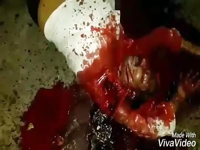 Horrible death in accident