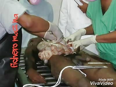 Necropsy to black with drugs