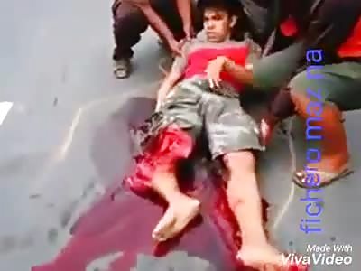 Man with leg shredded by truck