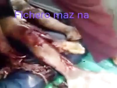 * Raising the dead to the truck*