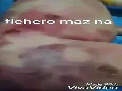 Terrible disease wing skin (very sad)