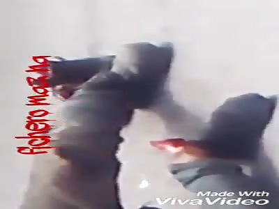 The ankle was broken and the bone was seen