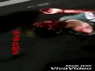 Agonizing motorcyclist