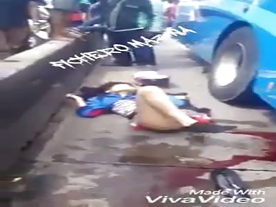 Legless Girl in Shock Waits For Help